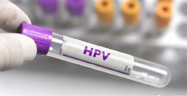 ͯ˻׿ȷȾHPV